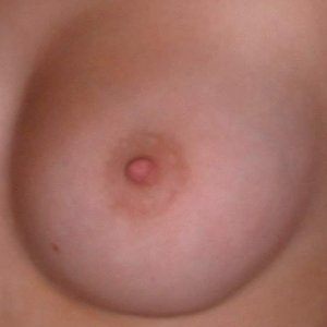 (1) Erotik Kontakt aus *****