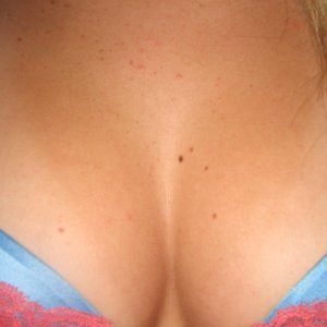 (10) Erotik Kontakt aus Simmelsdorf